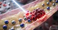 Replacement of Gold Nanoparticles for Laser Cancer Treatment in Russia