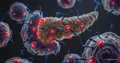 Daraxonacib for Pancreatic Cancer: Risks and Survival